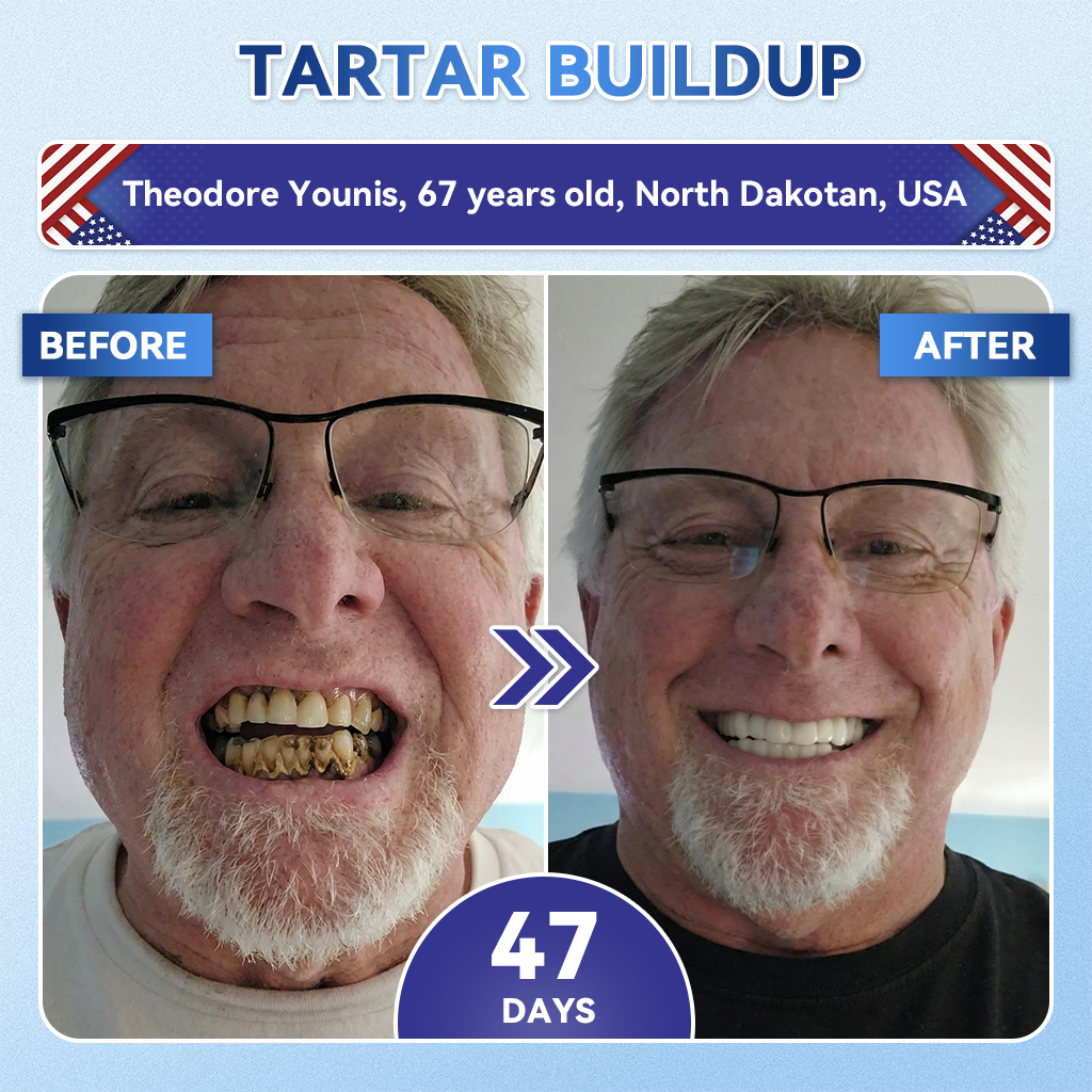 Your Smile~ NESLEMY® 🦷 Tideglusib Fast‑Dissolving Tooth & Gum Repair Oral Strips ✨ (𝟓-𝐢𝐧-𝟏 💎 𝐑𝐞𝐛𝐮𝐢𝐥𝐝 𝐄𝐧𝐚𝐦𝐞𝐥 & 𝐃𝐞𝐧𝐭𝐢𝐧 • 𝐒𝐭𝐫𝐞𝐧𝐠𝐭𝐡𝐞𝐧 𝐆𝐮𝐦𝐬 • 𝐄𝐫𝐚𝐝𝐢𝐜𝐚𝐭𝐞 𝐓𝐚𝐫𝐭𝐚𝐫 & 𝐎𝐝𝐨𝐫 • 𝐖𝐡𝐢𝐭𝐞𝐧𝐢𝐧𝐠 • 𝐒𝐭𝐨𝐩 𝐓𝐨𝐨𝐭𝐡 𝐒𝐞𝐧𝐬𝐢𝐭𝐢𝐯𝐢𝐭𝐲)